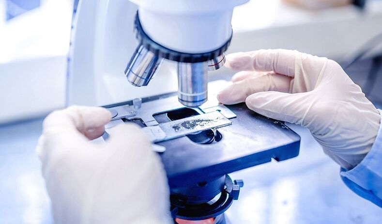 diagnosi di laboratorio del fungo dell'unghia del piede