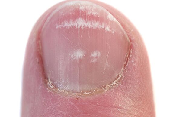 I primi segni e sintomi