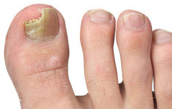 Varie forme di fungo