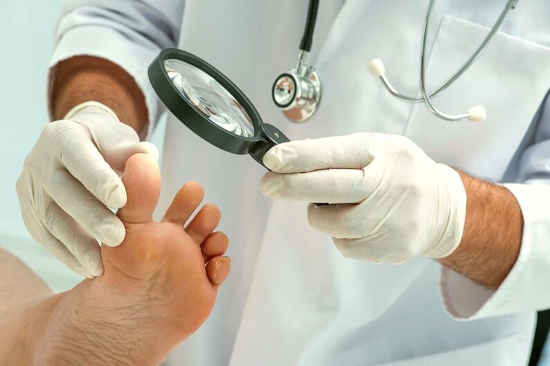 dermatologo che esamina le unghie dei piedi