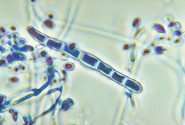 Fungo Trichophyton rubrum al microscopio