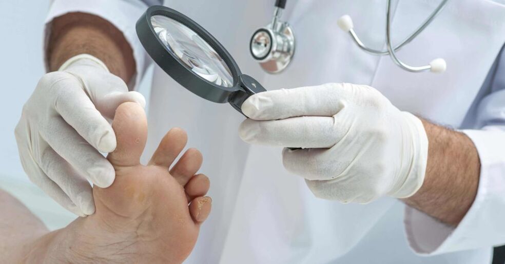 il medico esamina i piedi per i funghi